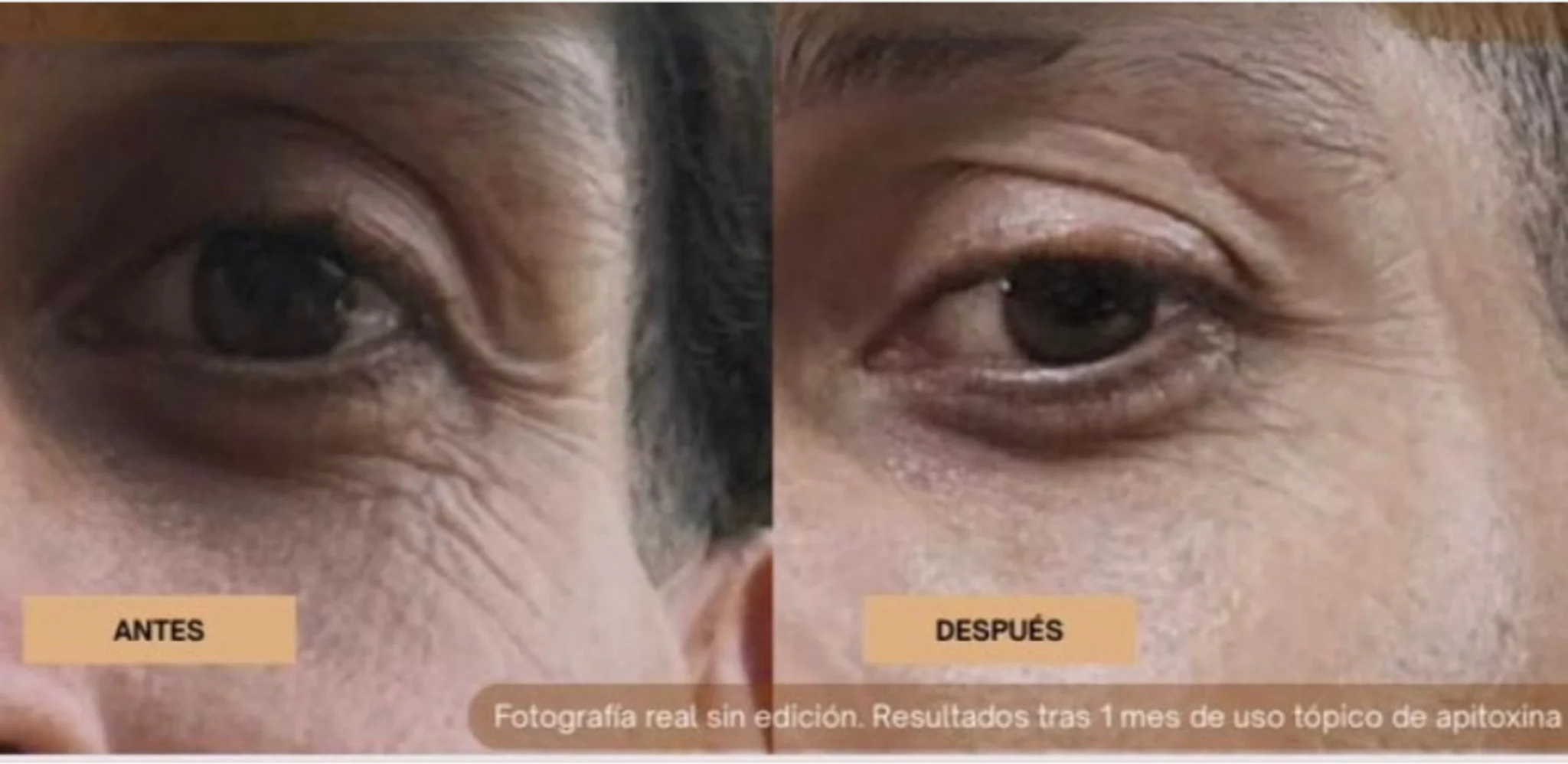 Antes y Después 1