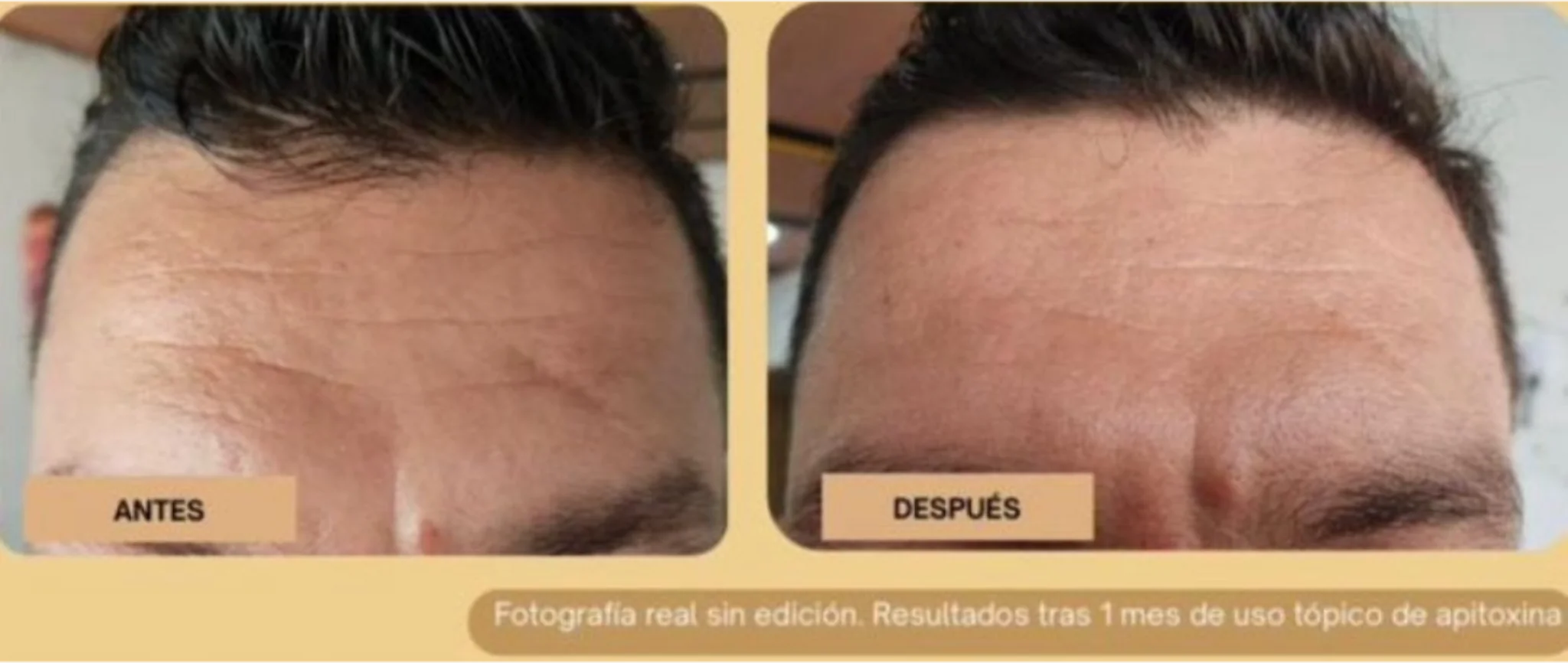 Antes y Después 2